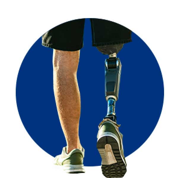 Man with prosthetic leg wearing shorts